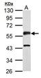 Calcium/Calmodulin Dependent Protein Kinase II Alpha antibody, GTX127939, GeneTex, Western Blot image 