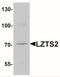 LZTS2 antibody, NBP2-41152, Novus Biologicals, Western Blot image 