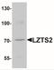 Leucine Zipper Tumor Suppressor 2 antibody, NBP2-41152, Novus Biologicals, Western Blot image 