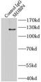 SH3 Domain Binding Protein 4 antibody, FNab07830, FineTest, Immunoprecipitation image 