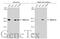 SWI/SNF Related, Matrix Associated, Actin Dependent Regulator Of Chromatin, Subfamily A, Member 2 antibody, GTX133724, GeneTex, Western Blot image 