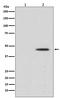 Mitogen-Activated Protein Kinase Kinase 1 antibody, P00292-3, Boster Biological Technology, Western Blot image 
