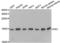 Fission, Mitochondrial 1 antibody, LS-C334315, Lifespan Biosciences, Western Blot image 