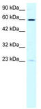 SPT3 Homolog, SAGA And STAGA Complex Component antibody, TA329655, Origene, Western Blot image 