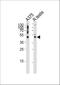 Adaptor Related Protein Complex 1 Subunit Mu 1 antibody, A10072-1, Boster Biological Technology, Western Blot image 