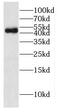 Dolichyl-Diphosphooligosaccharide--Protein Glycosyltransferase Non-Catalytic Subunit antibody, FNab02290, FineTest, Western Blot image 