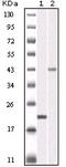 Aurora Kinase B antibody, STJ97851, St John