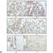 Ribosomal Protein S6 Kinase A1 antibody, LS-C812764, Lifespan Biosciences, Immunohistochemistry paraffin image 