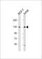 CCCTC-Binding Factor antibody, M00132-1, Boster Biological Technology, Western Blot image 