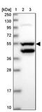 Coiled-Coil Domain Containing 149 antibody, PA5-61620, Invitrogen Antibodies, Western Blot image 