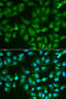 Galectin 3 antibody, 15-645, ProSci, Immunohistochemistry frozen image 