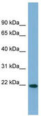 Fibronectin Type III Domain Containing 4 antibody, TA338623, Origene, Western Blot image 