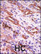 G Protein-Coupled Receptor Kinase 1 antibody, 62-581, ProSci, Immunohistochemistry paraffin image 