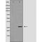 Vesicle-associated membrane protein-associated protein B antibody, orb229430, Biorbyt, Western Blot image 