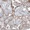 Ubiquitin Specific Peptidase 30 antibody, NBP2-59049, Novus Biologicals, Immunohistochemistry paraffin image 