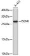 Density Regulated Re-Initiation And Release Factor antibody, 19-314, ProSci, Western Blot image 