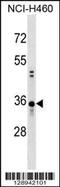 Coiled-Coil Domain Containing 137 antibody, 59-606, ProSci, Western Blot image 