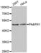 Poly(A) Binding Protein Nuclear 1 antibody, abx004649, Abbexa, Western Blot image 