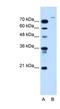 Ubiquitin carboxyl-terminal hydrolase 48 antibody, NBP1-59752, Novus Biologicals, Western Blot image 