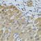 Forkhead Box O3 antibody, 13-033, ProSci, Immunohistochemistry paraffin image 