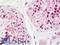 Kinesin Family Member 2C antibody, LS-B11053, Lifespan Biosciences, Immunohistochemistry frozen image 