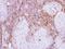 Peripherin antibody, NBP2-19774, Novus Biologicals, Immunohistochemistry paraffin image 