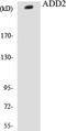 Adducin 2 antibody, EKC1017, Boster Biological Technology, Western Blot image 