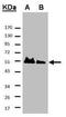 HAUS Augmin Like Complex Subunit 8 antibody, PA5-21331, Invitrogen Antibodies, Western Blot image 