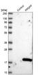 Integrin Subunit Alpha 5 antibody, NBP1-88304, Novus Biologicals, Western Blot image 
