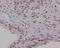 Pim-1 Proto-Oncogene, Serine/Threonine Kinase antibody, M01184, Boster Biological Technology, Immunohistochemistry frozen image 