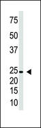 Interferon Lambda 1 antibody, LS-C97859, Lifespan Biosciences, Western Blot image 