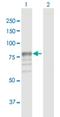 Glucuronidase Beta antibody, H00002990-D01P, Novus Biologicals, Western Blot image 