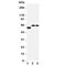 Solute Carrier Family 1 Member 4 antibody, R31308, NSJ Bioreagents, Western Blot image 