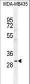 C-Type Lectin Domain Containing 10A antibody, LS-C168826, Lifespan Biosciences, Western Blot image 