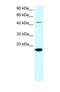 Matrix Metallopeptidase 19 antibody, PA1-24424, Invitrogen Antibodies, Western Blot image 