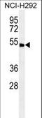 Abhydrolase Domain Containing 8 antibody, LS-C155876, Lifespan Biosciences, Western Blot image 