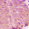 Transglutaminase 2 antibody, LS-C352936, Lifespan Biosciences, Immunohistochemistry paraffin image 