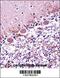 Retinoic Acid Receptor Alpha antibody, 57-306, ProSci, Immunohistochemistry frozen image 