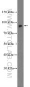 TNF Alpha Induced Protein 3 antibody, 23456-1-AP, Proteintech Group, Western Blot image 