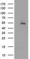 Histone Deacetylase 1 antibody, CF502142, Origene, Western Blot image 