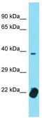 Transcription Factor 12 antibody, TA343370, Origene, Western Blot image 