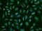 Procollagen-Lysine,2-Oxoglutarate 5-Dioxygenase 3 antibody, 202965-T02, Sino Biological, Immunohistochemistry frozen image 