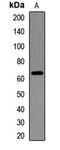 Insulin Like Growth Factor 2 MRNA Binding Protein 3 antibody, LS-C668277, Lifespan Biosciences, Western Blot image 