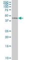 Zinc Finger Protein 24 antibody, H00007572-M02, Novus Biologicals, Western Blot image 