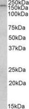 CAP-Gly Domain Containing Linker Protein 1 antibody, NBP1-36749, Novus Biologicals, Western Blot image 