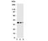 Wnt Family Member 2B antibody, R31091, NSJ Bioreagents, Western Blot image 