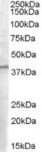 Eukaryotic Translation Initiation Factor 3 Subunit M antibody, NB100-2420, Novus Biologicals, Western Blot image 