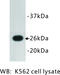 GFP antibody, MBS355126, MyBioSource, Western Blot image 