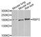 Retinol Binding Protein 3 antibody, A6403, ABclonal Technology, Western Blot image 