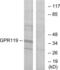 G Protein-Coupled Receptor 119 antibody, LS-B6791, Lifespan Biosciences, Western Blot image 